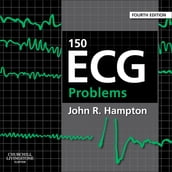 150 ECG Problems E-Book