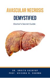 Avascular Necrosis Demystified: Doctor s Secret Guide