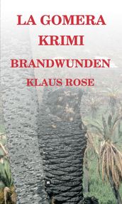 Brandwunden