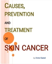 Causes, Prevention and Treatment of Skin Cancer