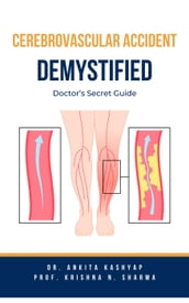 Cerebrovascular Accident Demystified: Doctor s Secret Guide
