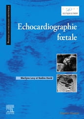 Echocardiographie fœtale