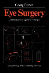 Eye Surgery