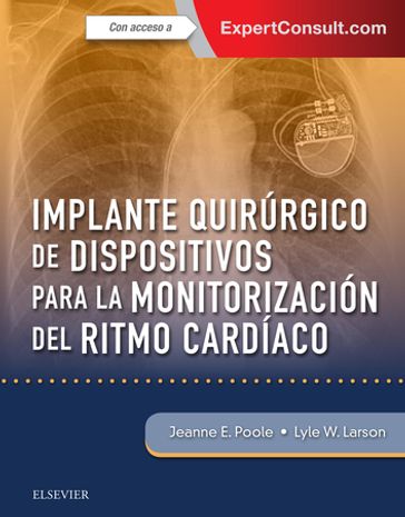 Implante quirúrgico de dispositivos para la monitorización del ritmo cardíaco - MD Jeanne Poole - PA-C  PhD Lyle W. Larson