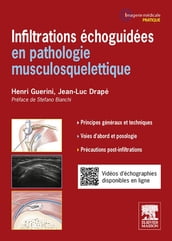 Infiltrations échoguidées