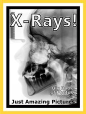 Just X-Ray Photos! Big Book of Photographs & Pictures of X-Rays, Medical Xray, Hospital Xrays, Vol. 1