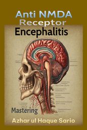 Mastering Anti NMDA Receptor Encephalitis