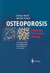 OSTEOPOROSIS