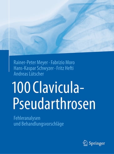 100 Clavicula-Pseudarthrosen - Fabrizio Moro - Fritz Hefti - Hans-Kaspar Schwyzer - Rainer-Peter Meyer