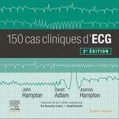 150 cas cliniques d ECG