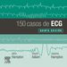 150 casos de ECG