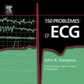 150 problèmes d ECG