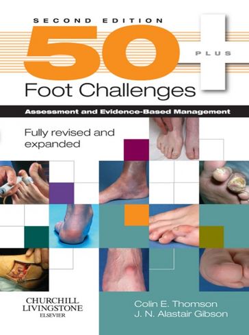 50+ Foot Challenges - Colin Thomson - J. N. Alastair Gibson