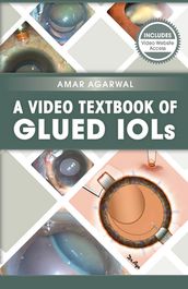 A Video Textbook of Glued IOLs