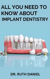 ALL YOU NEED TO KNOW ABOUT IMPLANT DENTISTRY