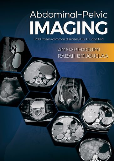 Abdominal-Pelvic Imaging - AMMAR HAOUIMI