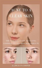 Acne to a Clear Skin: Saying Goodbye to all Skin Blemishes in 7 Days