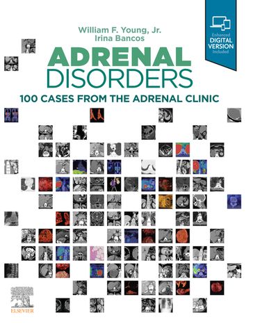 Adrenal Disorders - MD Irina Bancos - MD William F. Young