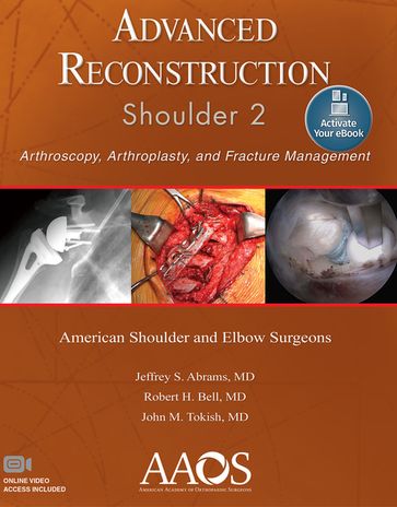 Advanced Reconstruction: Shoulder 2 - MD Jeffrey S. Abrams - MD John M. Tokish - MD Robert H. Bell