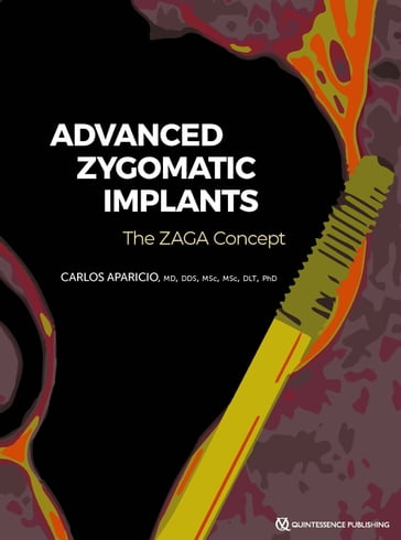 Advanced Zygomatic Implants - Carlos Aparicio