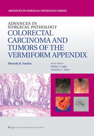 Advances in Surgical Pathology: Colorectal Carcinoma and Tumors of the Vermiform Appendix - Rhonda Yantiss