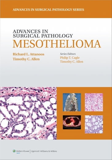 Advances in Surgical Pathology: Mesothelioma - Richard L. Attanoos - Timothy C. Allen