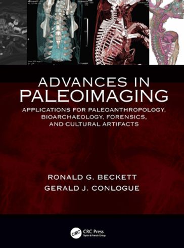 Advances in Paleoimaging - Gerald J. Conlogue - Ronald G. Beckett