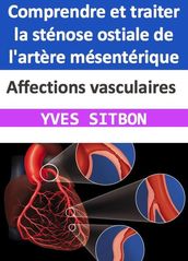 Affections vasculaires : Comprendre et traiter la sténose ostiale de l artère mésentérique