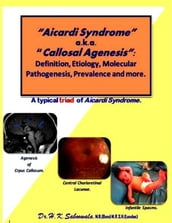 Aicardi Syndrome a.k.a. Callosal Agenesis: Definition, Etiology, Molecular Pathogenesis, Prevalence and more.