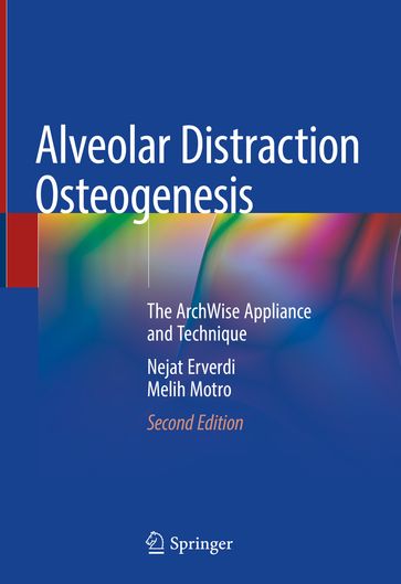 Alveolar Distraction Osteogenesis - Melih Motro - Nejat Erverdi