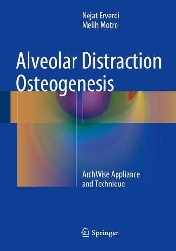 Alveolar Distraction Osteogenesis - Melih Motro - Nejat Erverdi