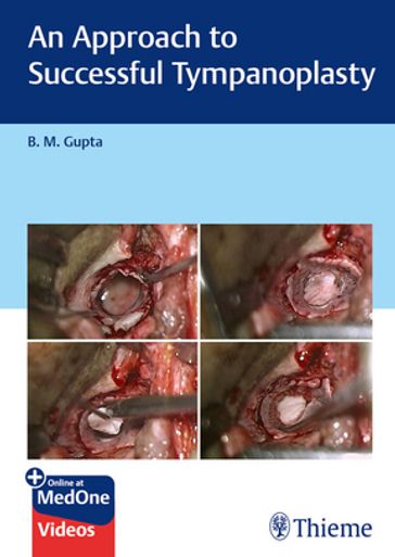 An Approach to Successful Tympanoplasty - B M Gupta