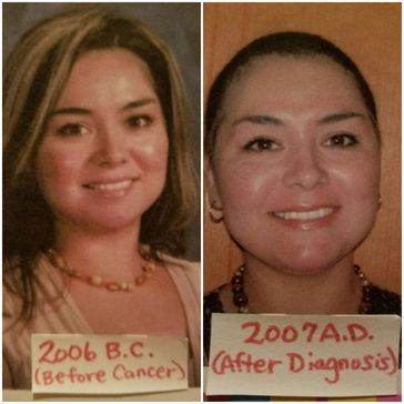 An Area of Concern - A Breast Cancer Story Preview - Trini Macias Ojeda