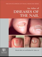 An Atlas of Diseases of the Nail