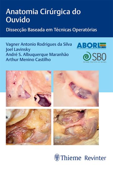 Anatomia Cirúrgica do Ouvido - Vagner Antonio Rodrigues da Silva - Joel Lavinsky - André S. Albuquerque Maranhão - Arthur Menino Castilho