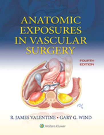 Anatomic Exposures in Vascular Surgery - Gary G. Wind - R. James Valentine