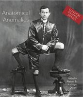 Anatomical Anomalies