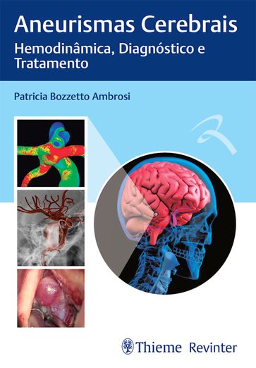 Aneurismas Cerebrais - Patricia Bozzetto Ambrosi