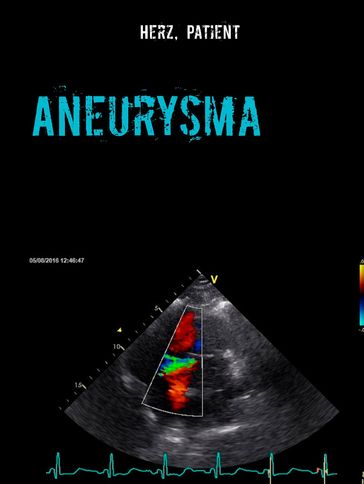 Aneurysma - Herz Patient