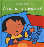 Anna ha la varicella!