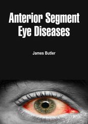 Anterior Segment Eye Diseases