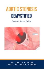 Aortic Stenosis Demystified: Doctor s Secret Guide