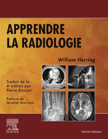 Apprendre la radiologie - William Herring - MD - FACR