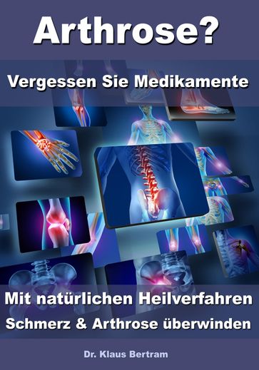 Arthrose?  Vergessen Sie Medikamente  Mit natürlichen Heilverfahren Schmerz & Arthrose überwinden - Dr. Klaus Bertram