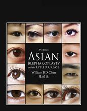 Asian Blepharoplasty and the Eyelid Crease E-Book