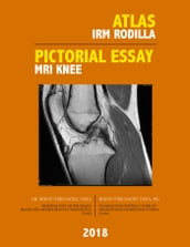 Atlas IRM Rodilla / Pictorial Essay MRI Knee