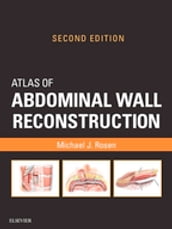 Atlas of Abdominal Wall Reconstruction E-Book