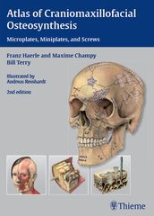 Atlas of Craniomaxillofacial Osteosynthesis