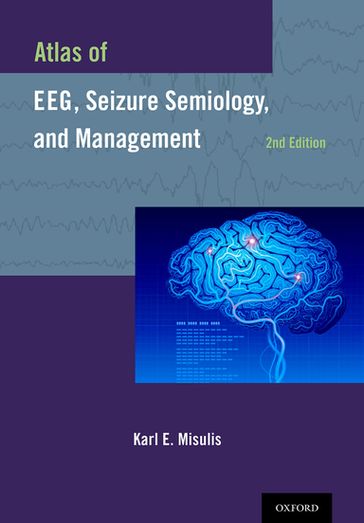 Atlas of EEG, Seizure Semiology, and Management - Karl E. Misulis