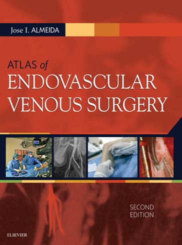 Atlas of Endovascular Venous Surgery E-Book - Jose Almeida - MD - Pa